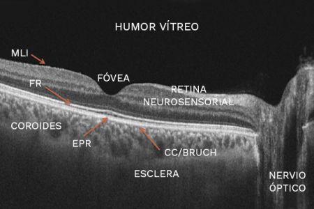 tomografia ocular oct