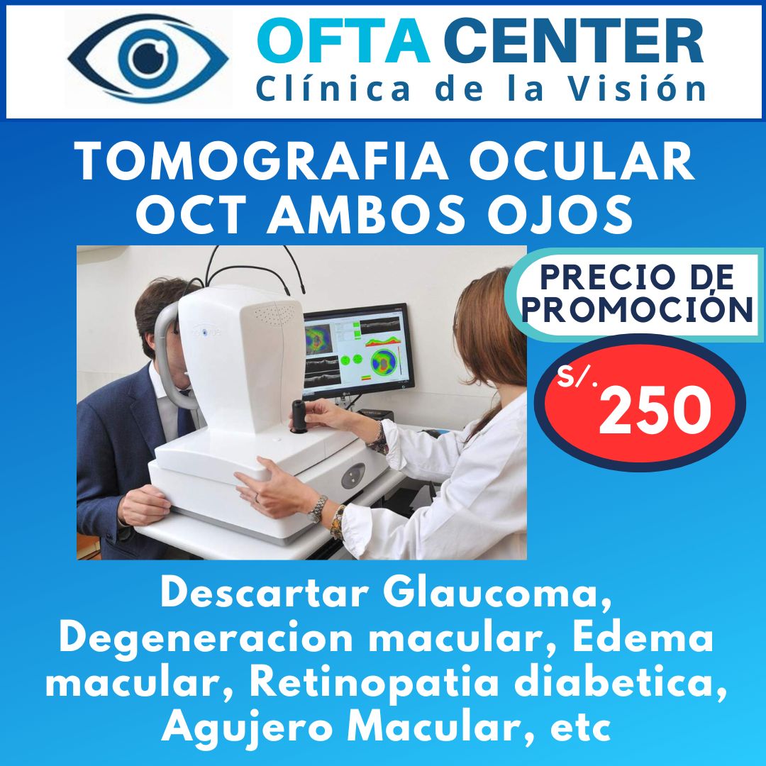 Tomografia ocular oct